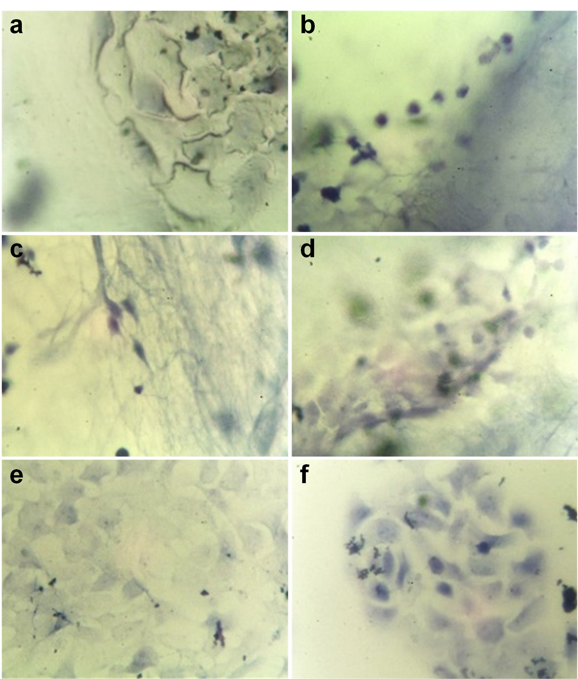 Optical microscopy images at 40X of human keratinocytes.